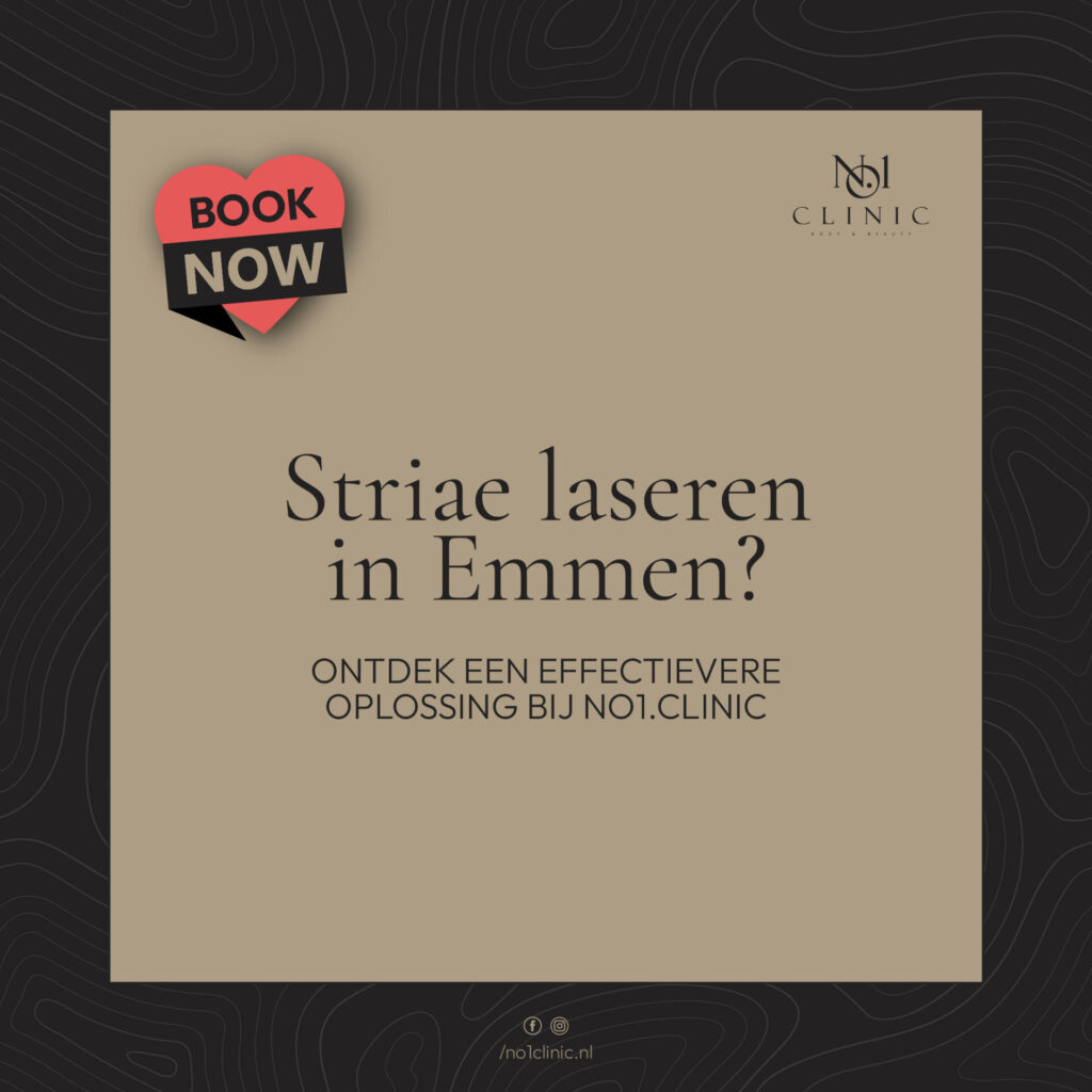 Striae laseren in Emmen